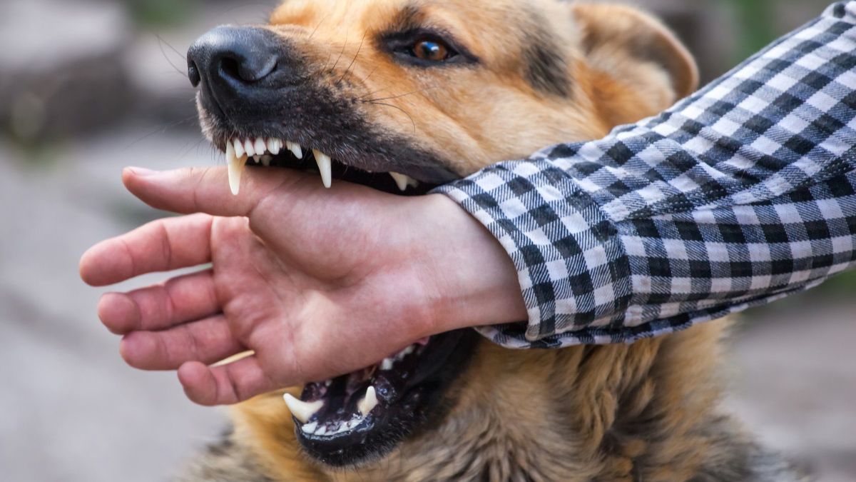 Perro mordiendo la mano de una persona