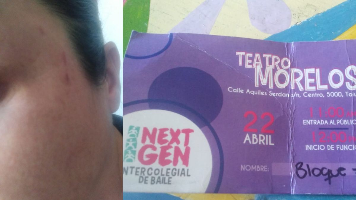 Boletos y golpes de fotógrafa