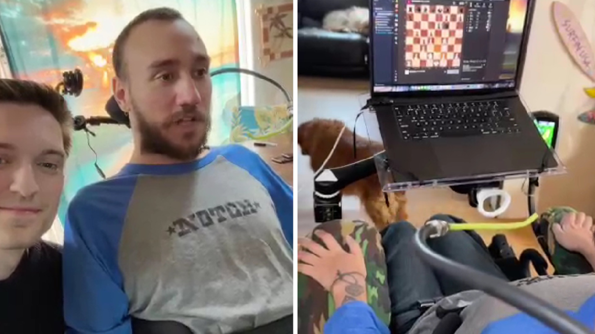 Neurolink paciente de Elon Musk