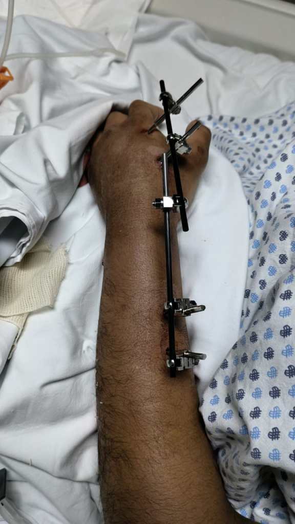 atropellamiento-valle-de-bravo