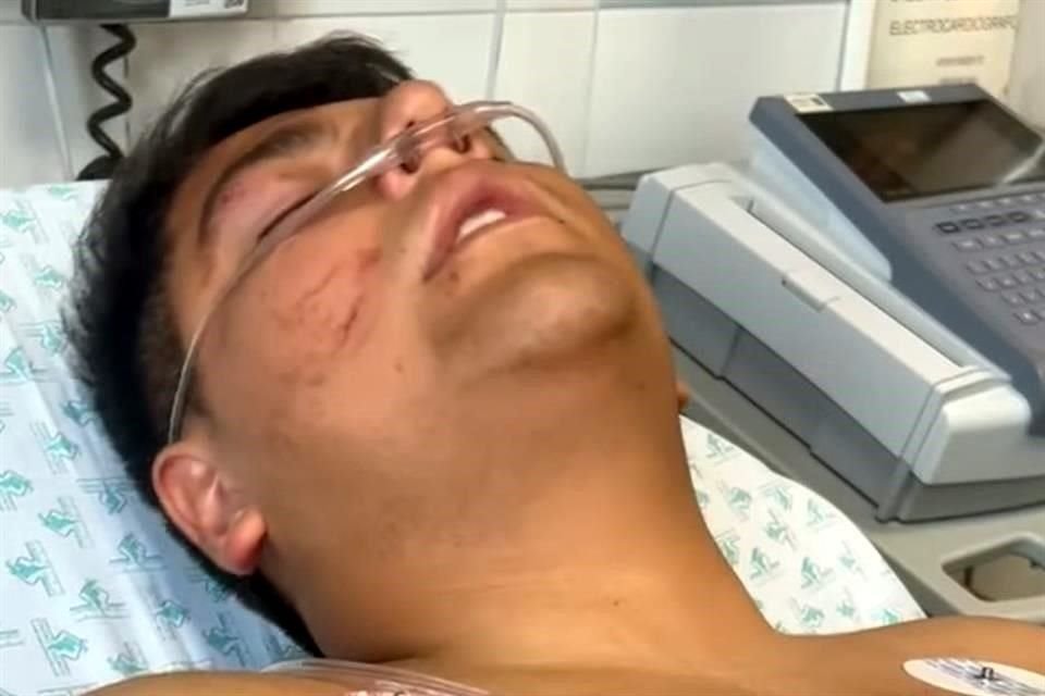 Joven con oxígeno en la cara, acostado en una cama de hospital con marcas visibles en su piel.