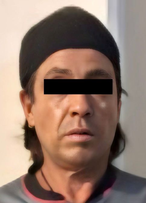 Retrato de un hombre con gorro negro y expresión seria, fondo difuso.