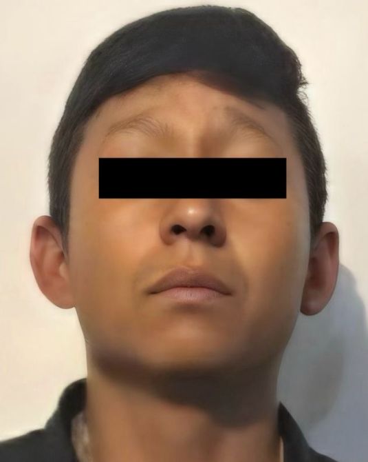 Retrato de un joven con cabello corto, mirando hacia enfrente, con expresión neutra y fondo claro.